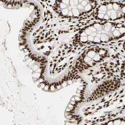 ILF2 Antibody, Novus Biologicals 25 &mu;L; Unlabeled:Antibodies, Polyclonal