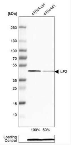 ILF2 Antibody, Novus Biologicals 25 &mu;L; Unlabeled:Antibodies, Polyclonal