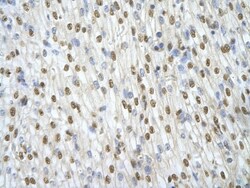 ILF3 Antibody, Novus Biologicals 0.05mg; Unlabeled:Antibodies, Polyclonal