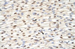 ILF3 Antibody, Novus Biologicals 0.05mg; Unlabeled:Antibodies, Polyclonal