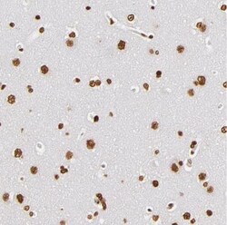 ILF3 Antibody, Novus Biologicals:Antibodies:Primary Antibodies