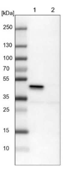 ILKAP/PP2C delta Antibody, Novus Biologicals 0.1mL; Unlabeled:Antibodies,