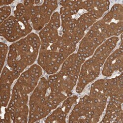 IMMP2L Antibody, Novus Biologicals:Antibodies:Primary Antibodies
