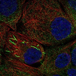 IMP Dehydrogenase 2/IMPDH2 Antibody, Novus Biologicals 0.1mL; Unlabeled:Antibodies,