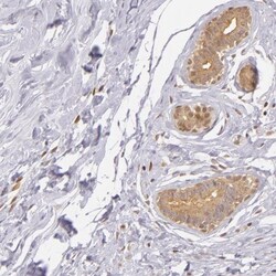 IMP Dehydrogenase 2/IMPDH2 Antibody, Novus Biologicals 0.1mL; Unlabeled:Antibodies,