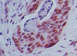 IMP Dehydrogenase 2/IMPDH2 Antibody, Novus Biologicals 0.1mg; Unlabeled:Antibodies,