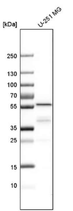 IMP Dehydrogenase 2/IMPDH2 Antibody, Novus Biologicals 0.1mL; Unlabeled:Antibodies,