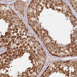 IMPACT Antibody, Novus Biologicals 25 &mu;L; Unlabeled:Antibodies, Polyclonal