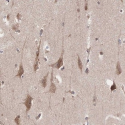 INF2 Antibody, Novus Biologicals 0.1mL; Unlabeled:Antibodies, Polyclonal