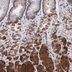 INF2 Antibody, Novus Biologicals 0.1mL; Unlabeled:Antibodies, Polyclonal