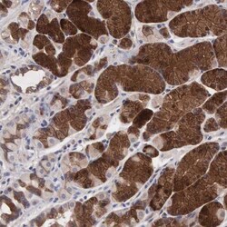 INF2 Antibody, Novus Biologicals 0.1mL; Unlabeled:Antibodies, Polyclonal
