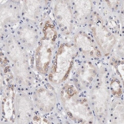 INF2 Antibody, Novus Biologicals 0.1mL; Unlabeled:Antibodies, Polyclonal