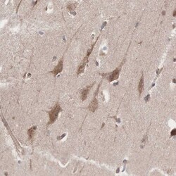 INF2 Antibody, Novus Biologicals 0.1mL; Unlabeled:Antibodies, Polyclonal