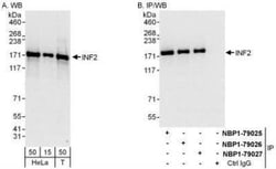 INF2 Antibody, Novus Biologicals 0.1mL; Unlabeled:Antibodies, Polyclonal