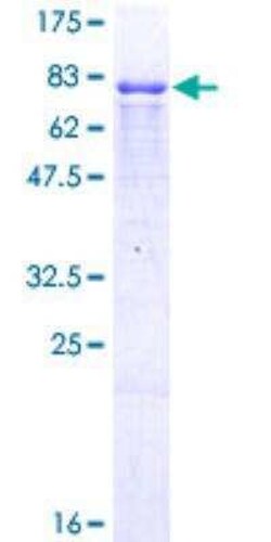 Novus Biologicals Recombinant Human ING3 GST (N-Term) Protein 10 &mu;g | Buy Online | Novus Biologicals&trade; | Fisher Scientific