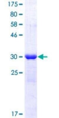 Novus Biologicals Recombinant Human ING3 GST (N-Term) Protein 10 &mu;g | Buy Online | Novus Biologicals&trade; | Fisher Scientific