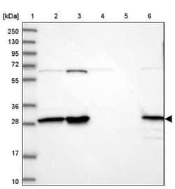 INO80E Antibody, Novus Biologicals 25 &mu;L; Unlabeled:Antibodies, Polyclonal