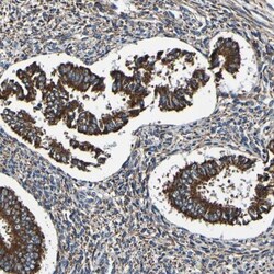 INPP5A Antibody, Novus Biologicals 0.1mL; Unlabeled:Antibodies, Polyclonal
