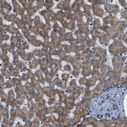 INPP5A Antibody, Novus Biologicals 0.1mL; Unlabeled:Antibodies, Polyclonal