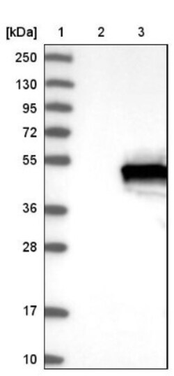 INPP5A Antibody, Novus Biologicals 0.1mL; Unlabeled:Antibodies, Polyclonal