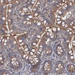 INPP5B Antibody, Novus Biologicals:Antibodies:Primary Antibodies