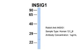 INSIG-2 Antibody, Novus Biologicals 0.05mg; Unlabeled:Anticuerpos