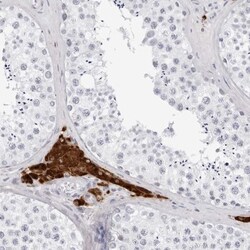 INSL3 Antibody, Novus Biologicals:Antibodies:Primary Antibodies