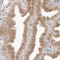INTS11 Antibody, Novus Biologicals 0.1mL; Unlabeled:Antibodies, Polyclonal
