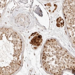 INTS11 Antibody, Novus Biologicals 0.1mL; Unlabeled:Antibodies, Polyclonal