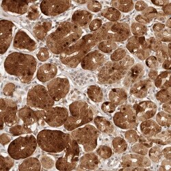 INTS11 Antibody, Novus Biologicals 0.1mL; Unlabeled:Antibodies, Polyclonal