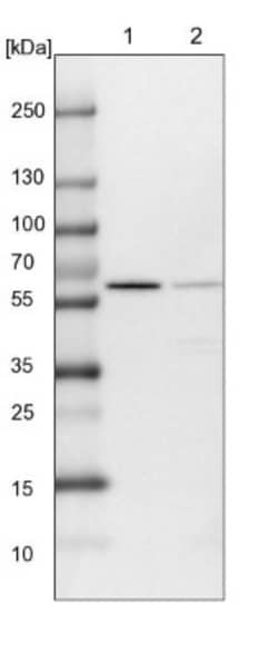 INTS11 Antibody, Novus Biologicals 0.1mL; Unlabeled:Antibodies, Polyclonal
