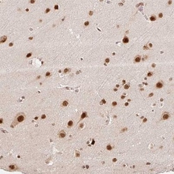 INTS8 Antibody, Novus Biologicals 0.1mL; Unlabeled:Antibodies, Polyclonal