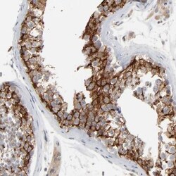 IP3R3 Antibody, Novus Biologicals:Antibodies:Primary Antibodies
