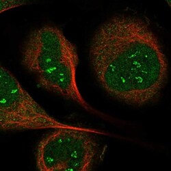 IP6K1 Antibody, Novus Biologicals 0.1mL; Unlabeled:Antistoffer