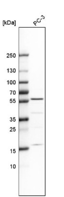IP6K1 Antibody, Novus Biologicals 0.1mL; Unlabeled:Antistoffer