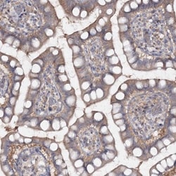 IPMK Antibody, Novus Biologicals 0.1mL; Unlabeled:Antibodies, Polyclonal