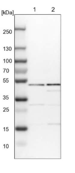 IPPK Antibody, Novus Biologicals 0.1mL; Unlabeled:Antibodies, Polyclonal