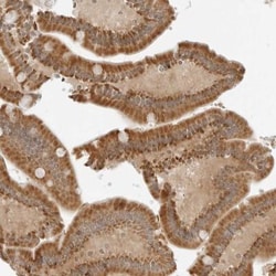 IQCC Antibody, Novus Biologicals 0.1mL; Unlabeled:Antibodies, Polyclonal