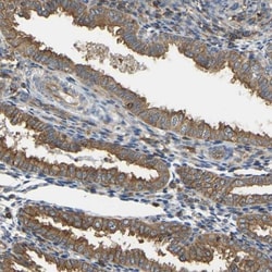 IQGAP1 Antibody, Novus Biologicals 0.1mL; Unlabeled:Antibodies, Polyclonal