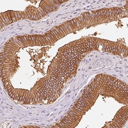 IQGAP2 Antibody, Novus Biologicals 0.1mL; Unlabeled:Antibodies, Polyclonal