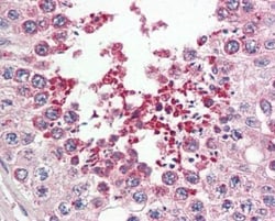 IRAK1BP1 Antibody, Novus Biologicals 0.1mL; Unlabeled:Antibodies, Polyclonal