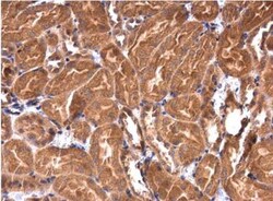 IRAK1BP1 Antibody, Novus Biologicals 0.1mL; Unlabeled:Antibodies, Polyclonal