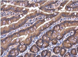 IRAK1BP1 Antibody, Novus Biologicals 0.1mL; Unlabeled:Antibodies, Polyclonal