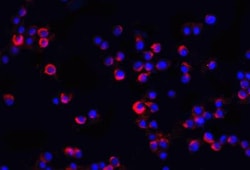 IRAK2 Antibody - BSA Free, Novus Biologicals 0.1mg; Unlabeled:Antibodies,