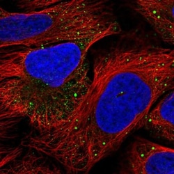 IRAK2 Antibody, Novus Biologicals 0.1mL; Unlabeled:Antibodies, Polyclonal