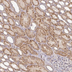 IRAK2 Antibody, Novus Biologicals 0.1mL; Unlabeled:Antibodies, Polyclonal