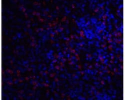 IRAK3 Antibody - BSA Free, Novus Biologicals 0.025 mg, Unconjugated:Antibodies,