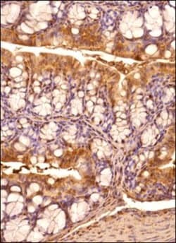 IRE1 alpha Antibody, Novus Biologicals 0.1mL; Unlabeled:Antibodies, Polyclonal