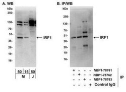 IRF1 Antibody, Novus Biologicals 0.1mg; Unlabeled:Antibodies, Polyclonal