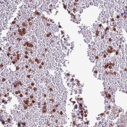 IRF5 Antibody, Novus Biologicals:Antibodies:Primary Antibodies